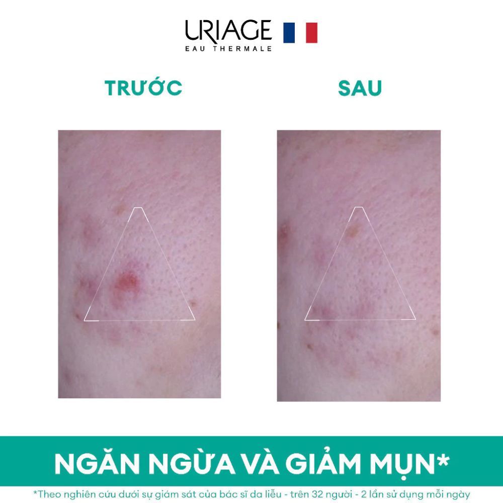 Ảnh 4 của Kem dưỡng URIAGE Hyseac 3-Regul + Anti Imperfections hỗ trợ giảm mụn, kiềm dầu 40ml