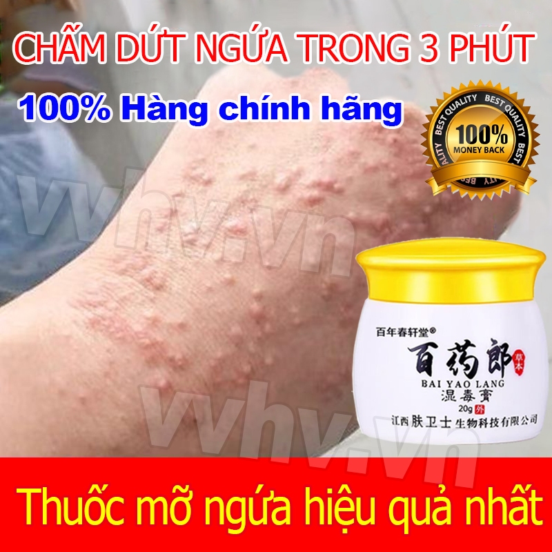 kem bôi nấm ngứa thuốc bôi ngứa trung quốc Điểm Viêm Da Cơ Địa Nấm Ngứa, Hắc Lào, Tổ Đỉa, Ghẻ Nước C