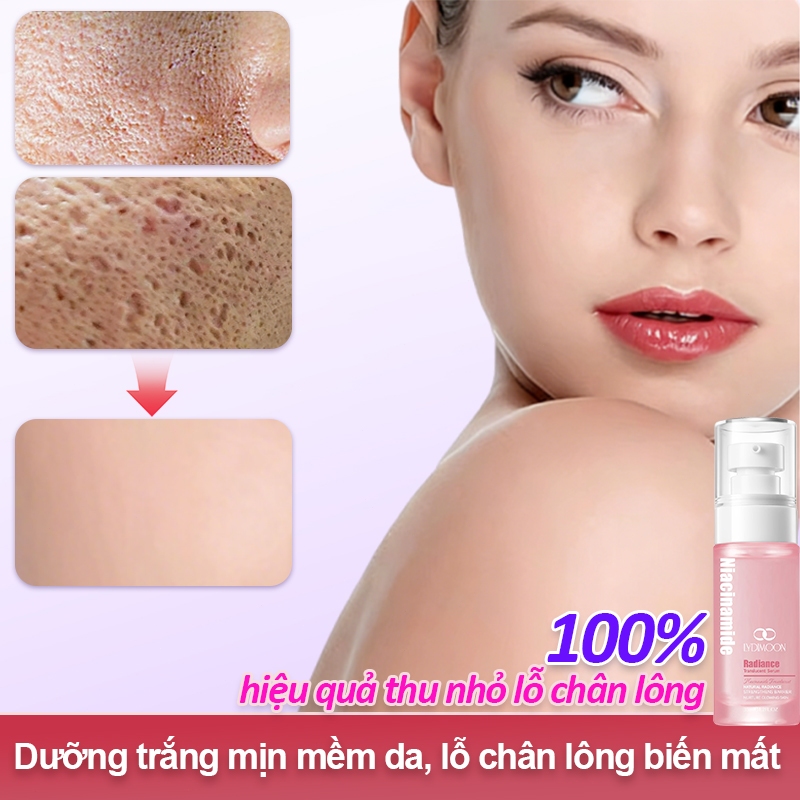 Serum Niacinamide LYDIMOON 35ML - Làm trắng da, thu nhỏ lỗ chân lông, loại bỏ mụn đầu đen, làm sáng 