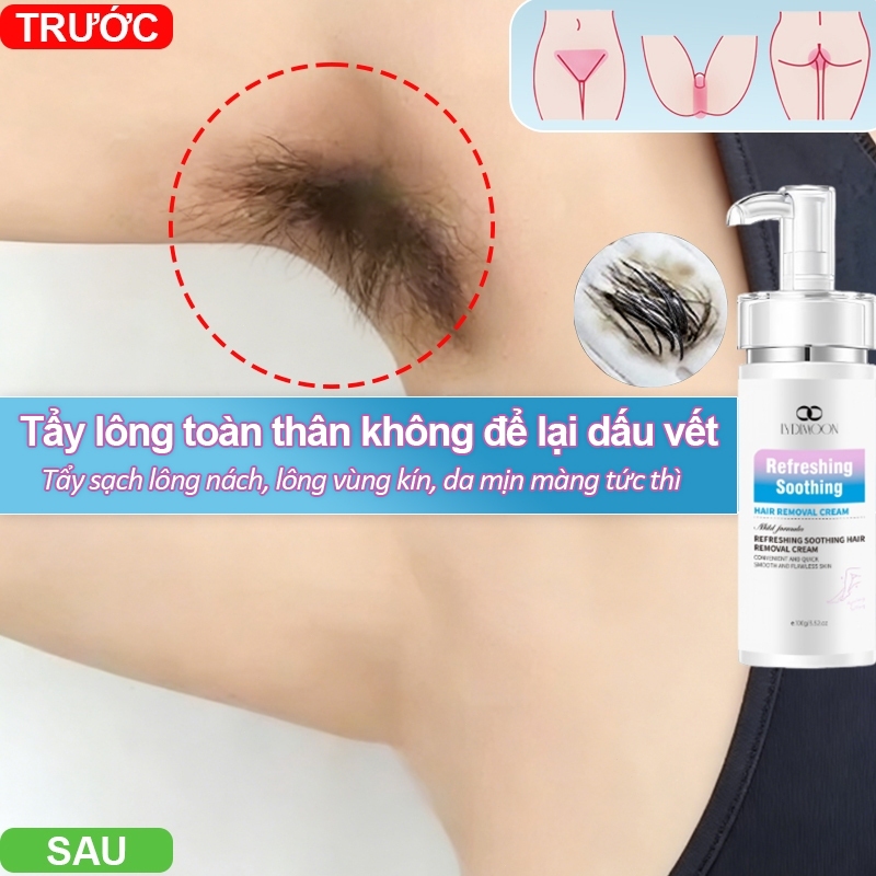 Kem tẩy lông LYDIMOON Youjia Shurou thích hợp cho vùng kín, nách, tay và chân 100g