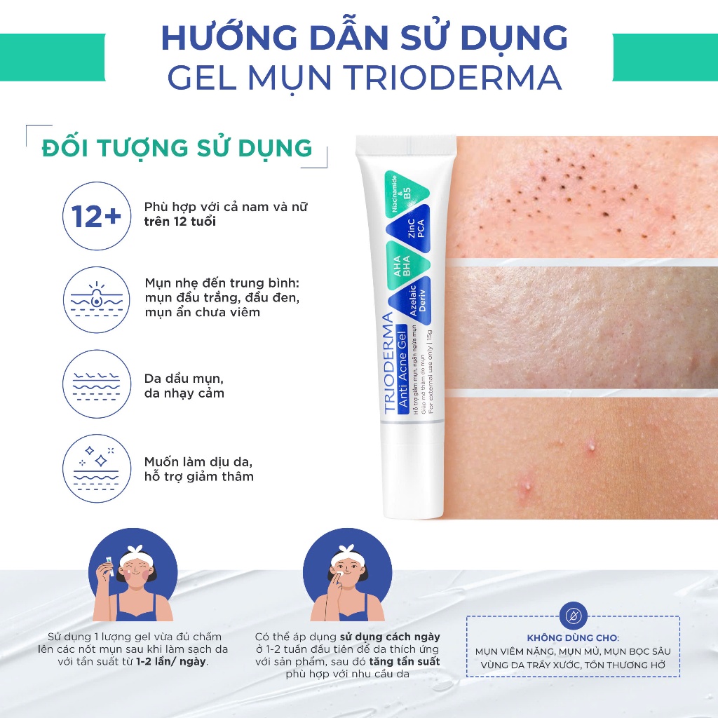Trioderma Anti Acne Gel 15g – Giải Pháp Chăm Sóc Da Mụn An Toàn, Dịu Nhẹ | BigBuy360 - bigbuy360.vn
