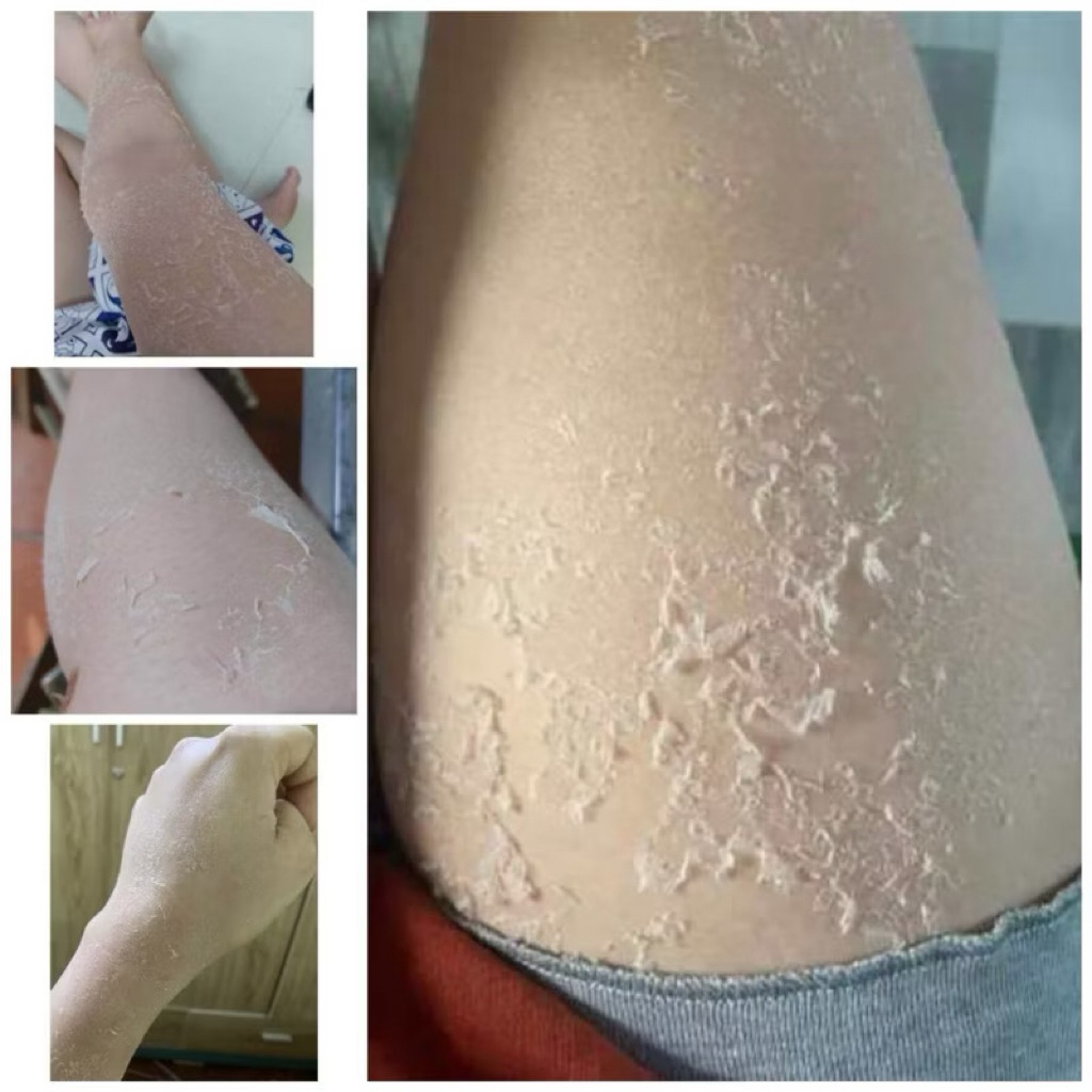 peel da body, bong da body, kem tái tạo da body handmade