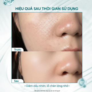 Mặt nạ đất sét xanh Placentor Purifying Mask 150ml