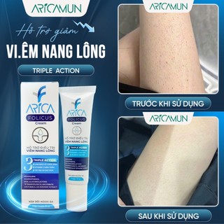 Kem Bôi Viêm Nang Lông Arica Folicus Hỗ Trợ Giảm Mụn Viêm Dày Sừng Nang Lông, Mờ Thâm Mụn Tuýp 30g