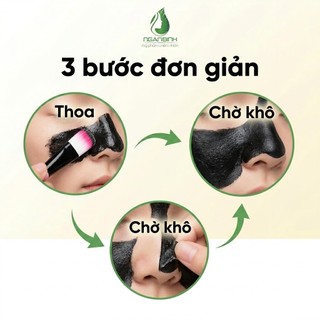 [TẶNG CỌ QUÉT] Keo lột mụn Ngân Bình 50g - Sạch mụn đầu đen, tế bào chết