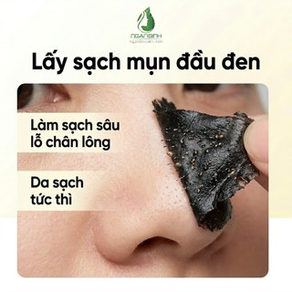 [TẶNG CỌ QUÉT] Keo lột mụn Ngân Bình 50g - Sạch mụn đầu đen, tế bào chết