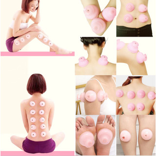 ✅ Bộ giác hơi không dùng lửa Hàn Quốc