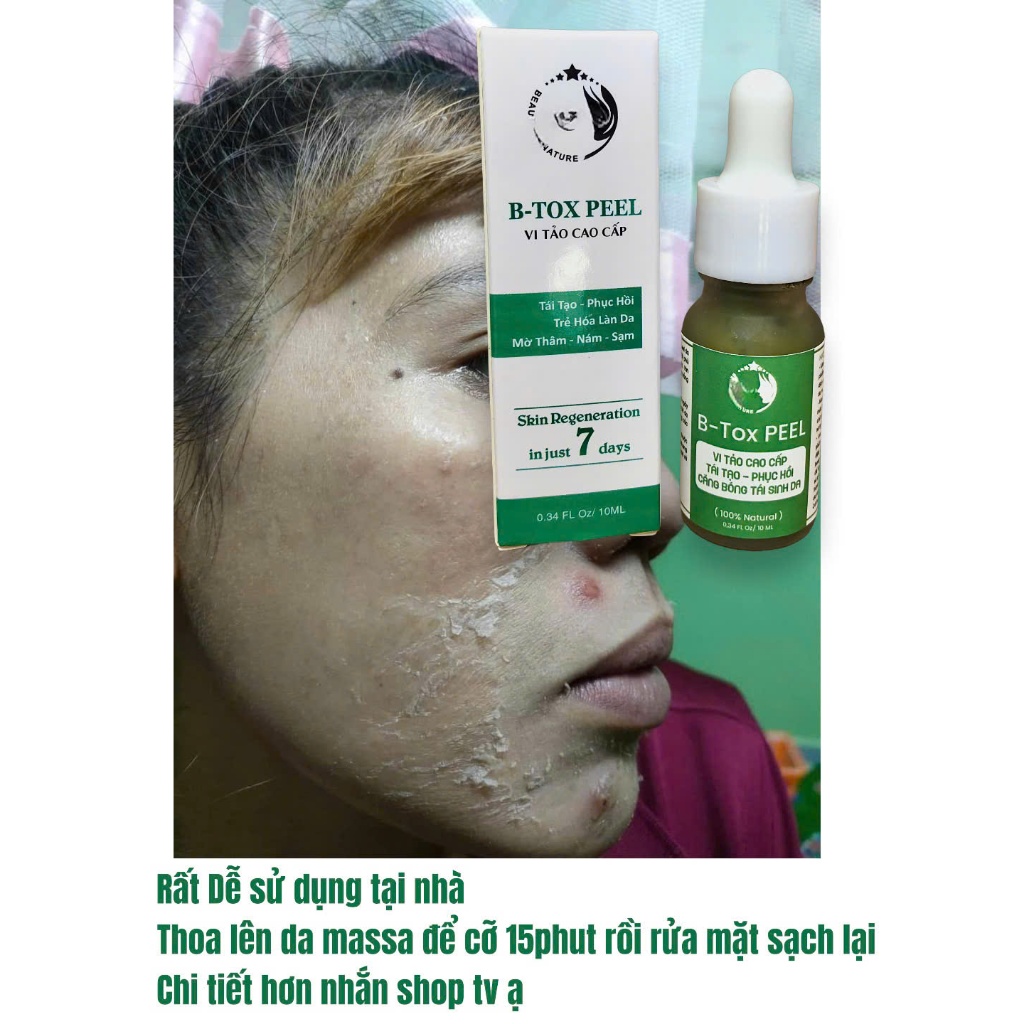B-Tox Peel Da Mặt Vi Tảo Cao Cấp 10ml - ( tẩy da chết - Pell lột da mặt - tái tạo da )