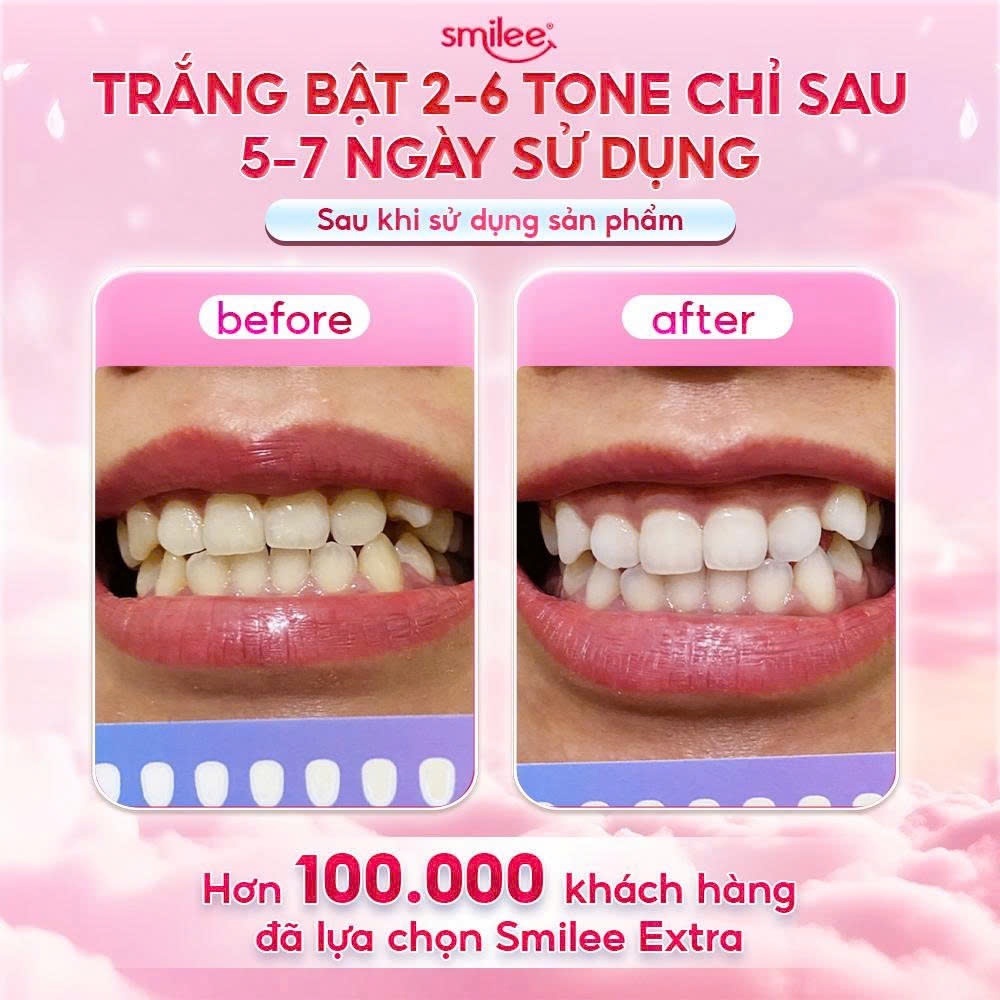 [GIÁ 678K TẠI LIVE SHOP] Trắng răng Smilee Extra, bộ kit làm trắng răng từ 2-6 tone tại nhà set quà tặng cho nữ LIS | BigBuy360 - bigbuy360.vn