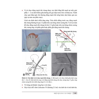 Sách - Điện quang can thiệp