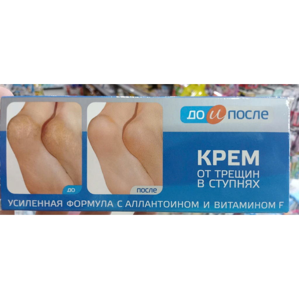Kem dưỡng da chân "Before & After KPEM 50ml