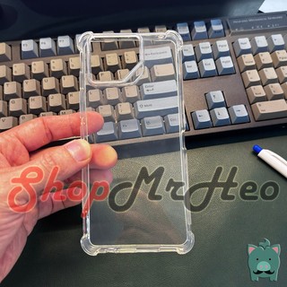 Ốp Lưng Dẻo Chống Sốc Trong Suốt ROG Phone 8 - ROG 8 - ROG Phone 7 - ROG7