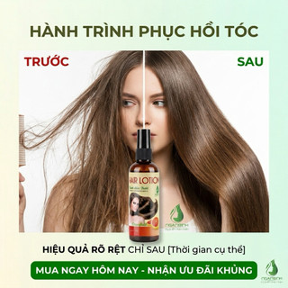Tinh Dầu Bưởi Mọc Tóc Ngân Bình Dạng Chai Xịt 100ml Hỗ Trợ Giảm Rụng, Dưỡng Tóc Suôn Mượt