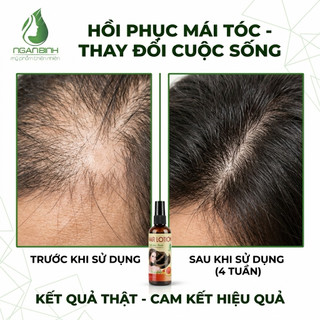 [CHÍNH HÃNG] Xịt Tinh Dầu Bưởi Mọc Tóc Giảm Gãy Rụng, Dưỡng Tóc Dày Mượt Chắc Khỏe 100ml