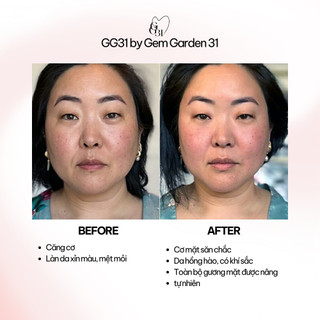 Đá Guasha Massage GG31 – Dụng Cụ Gua Sha Massage Mặt, Thư Giãn, Nâng Cơ, Chăm Sóc Da Tự Nhiên | GG31 by GemGarden31