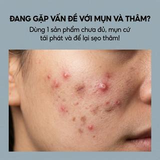 Kem mụn thâm Derma anti acnes (chính hãng)