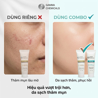 Kem mụn thâm Derma anti acnes (chính hãng)