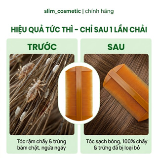 Lược Bí Chải Chấy Cho Bé - Lược Nhựa Dày 2 Mặt Răng Xít Chải Sạch Gàu Êm Da Đầu