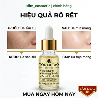 Toner Dấm Táo Cân Bằng Se Khít Lỗ Chân Lông Giảm Mụn, Phục Hồi Làm Dịu Da