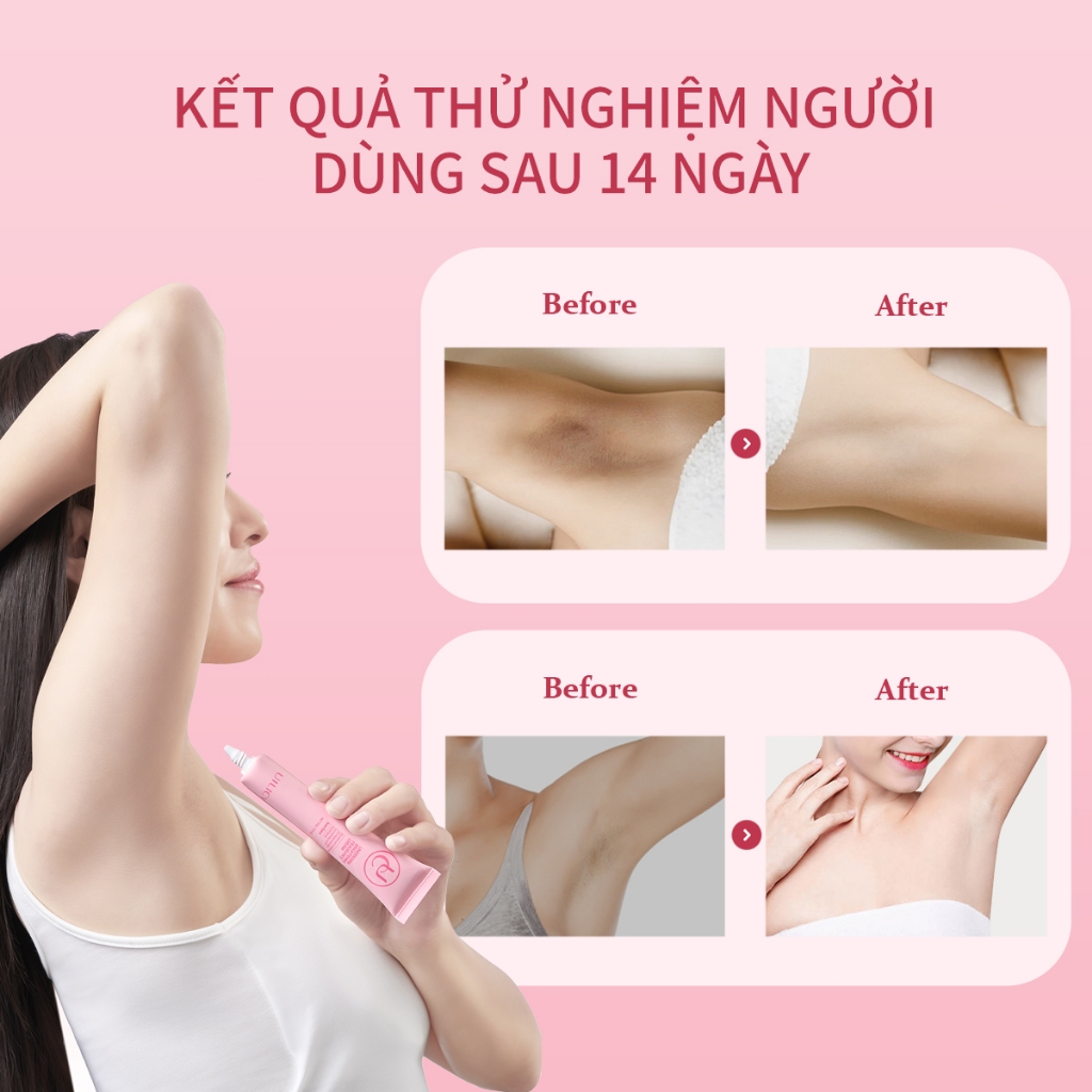 Kem dưỡng Hỗ trợ trắng sáng vùng da dưới cánh tay UILICY30g Khử Mùi Nách Trắng da Chống2% Niacinamide Symwhite377 Rose | BigBuy360 - bigbuy360.vn