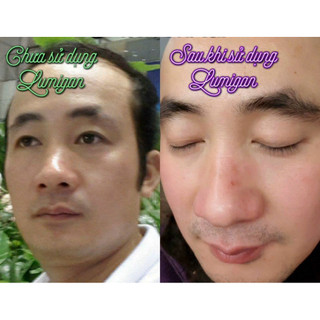 (DATE Tháng 8/2027) LUMIGAN Dưỡng Dài Mi