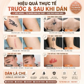 Miếng dán che hình xăm