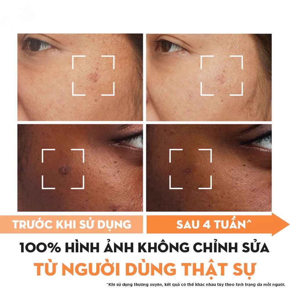 Ảnh 16 của Kem dưỡng ẩm, Serum OLAY LUMINOUS NIACINAMIDE + VITAMIN C mờ vết thâm, đốm nâu, sáng da 50g.