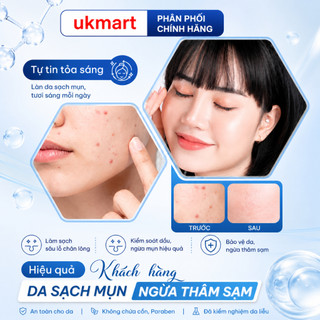 Gel Chấm Mụn Compliment Gom Cồi Nhanh, Giảm Sưng Đỏ, Kiềm Dầu Mờ Thâm Dành Cho Da Mụn 25ml