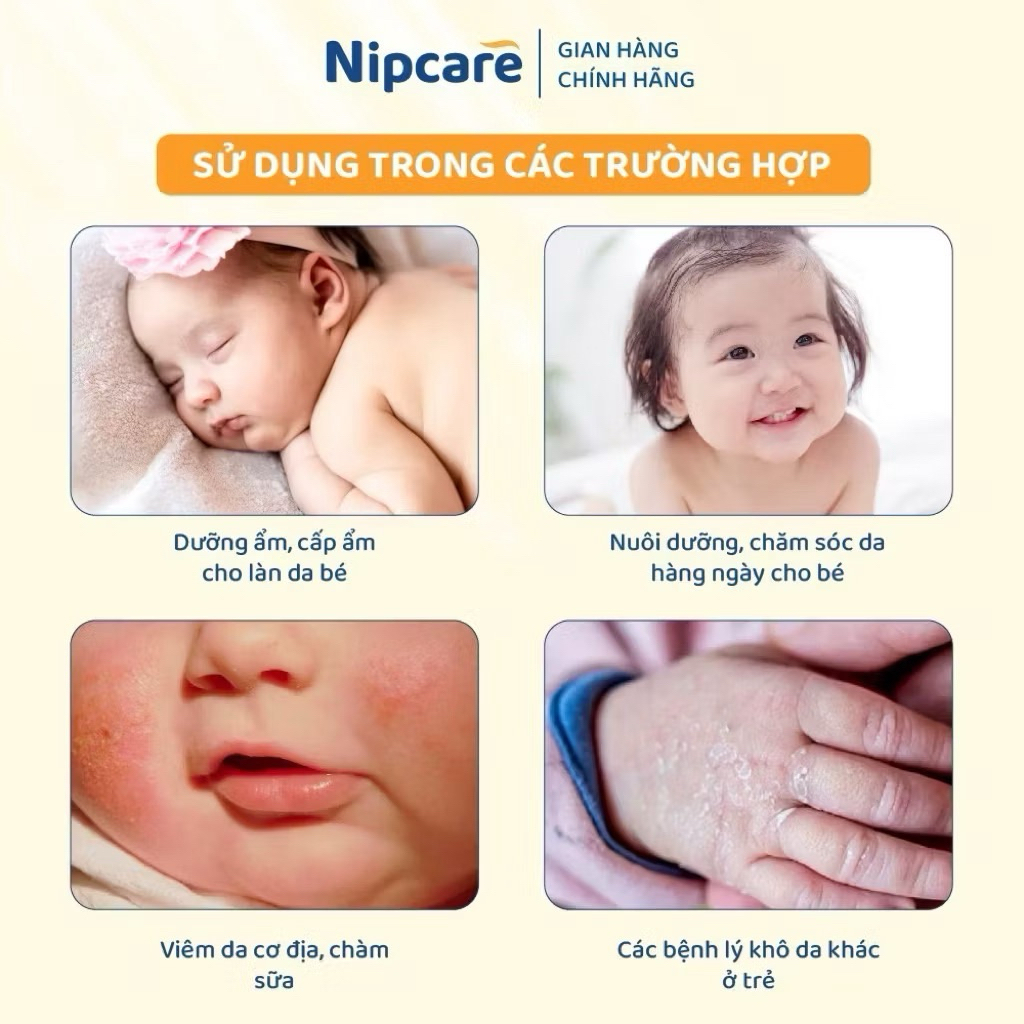 Kem Bôi da chàm sữa,mẩn ngứa,hăm bỉm cho bé,Kem bôi Chàm sữa cho bé Nipcare dưỡng ẩm