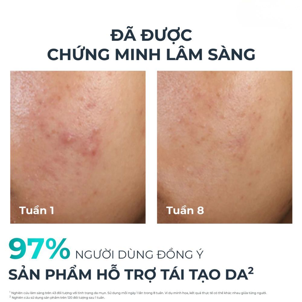 Ảnh 7 của Tinh chất Eucerin DermoPure Clinical Peeling 10 giảm mụn, nhờn và mờ thâm 40ml.