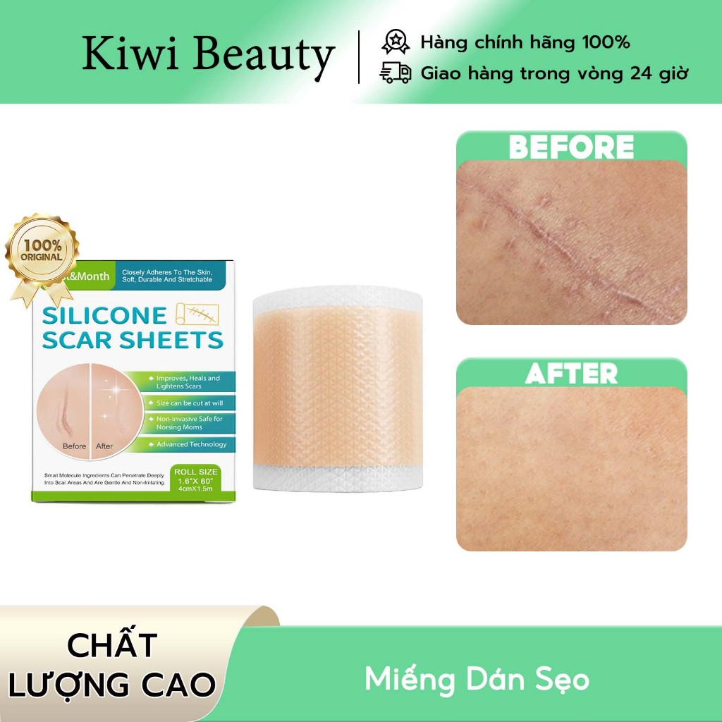 Miếng Dán Sẹo Lồi West Month Làm Mờ Sẹo Thâm Phẫu Thuật Cắt Được 1.5m