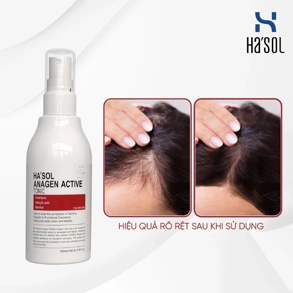Xịt Kích Mọc Tóc Hasol Anagen Active Tonic Dưỡng Da Đầu Nuôi Dưỡng Nang Tóc Lão Hóa Chắc Khỏe Dành C