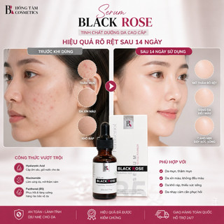 Serum Black Rose Mulrose Phục Hồi Da Mờ Thâm Cấp Ẩm