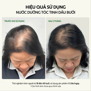 [Cải tiến mới] Nước dưỡng tóc tinh dầu bưởi COCOON| Ngăn ngừa gãy rụng, hỗ trợ mọc tóc