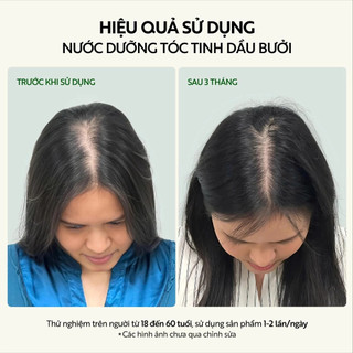 [Cải tiến mới] Nước dưỡng tóc tinh dầu bưởi COCOON| Ngăn ngừa gãy rụng, hỗ trợ mọc tóc