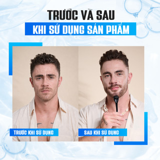 Thanh lăn râu Derma Roller Rhys Man