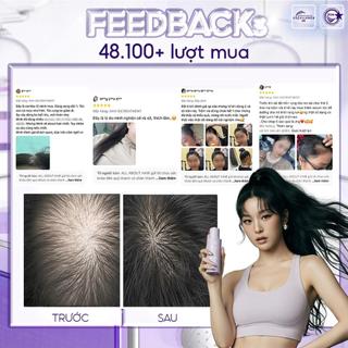 Combo Dầu Gội, Dầu Xả, Ủ Oil, Xịt Dưỡng Tóc Biotin AAH Chăm Sóc Và Phục Hồi, Dưỡng Tóc Toàn Diện