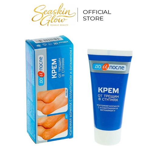 Kem dưỡng ẩm KPEM chống nứt nẻ gót chân Before and After 50ml