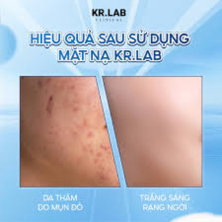Mặt Nạ B5 Kr.Lab EGF Complex Mask Phục Hồi Da Chuyên Sâu, Thúc Đẩy Tái Tạo Da, Làm Dịu Da Tức Thì Và Giảm Đỏ Rát