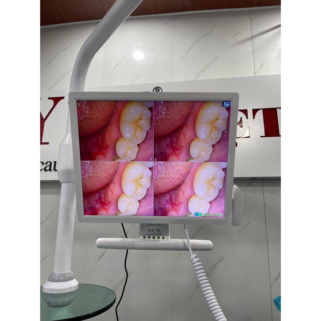 Bộ camera nội soi DYM dùng trong nha khoa [ gồm tay camera nội soi + Màn hình ]