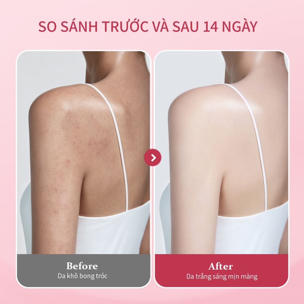 Dưỡng thể dưỡng trắng UILICY 200ml Serum dưỡng thể Làm trắng 2%Niacinamide Symwhite377 Đa dạng hương nước hoa | BigBuy360 - bigbuy360.vn