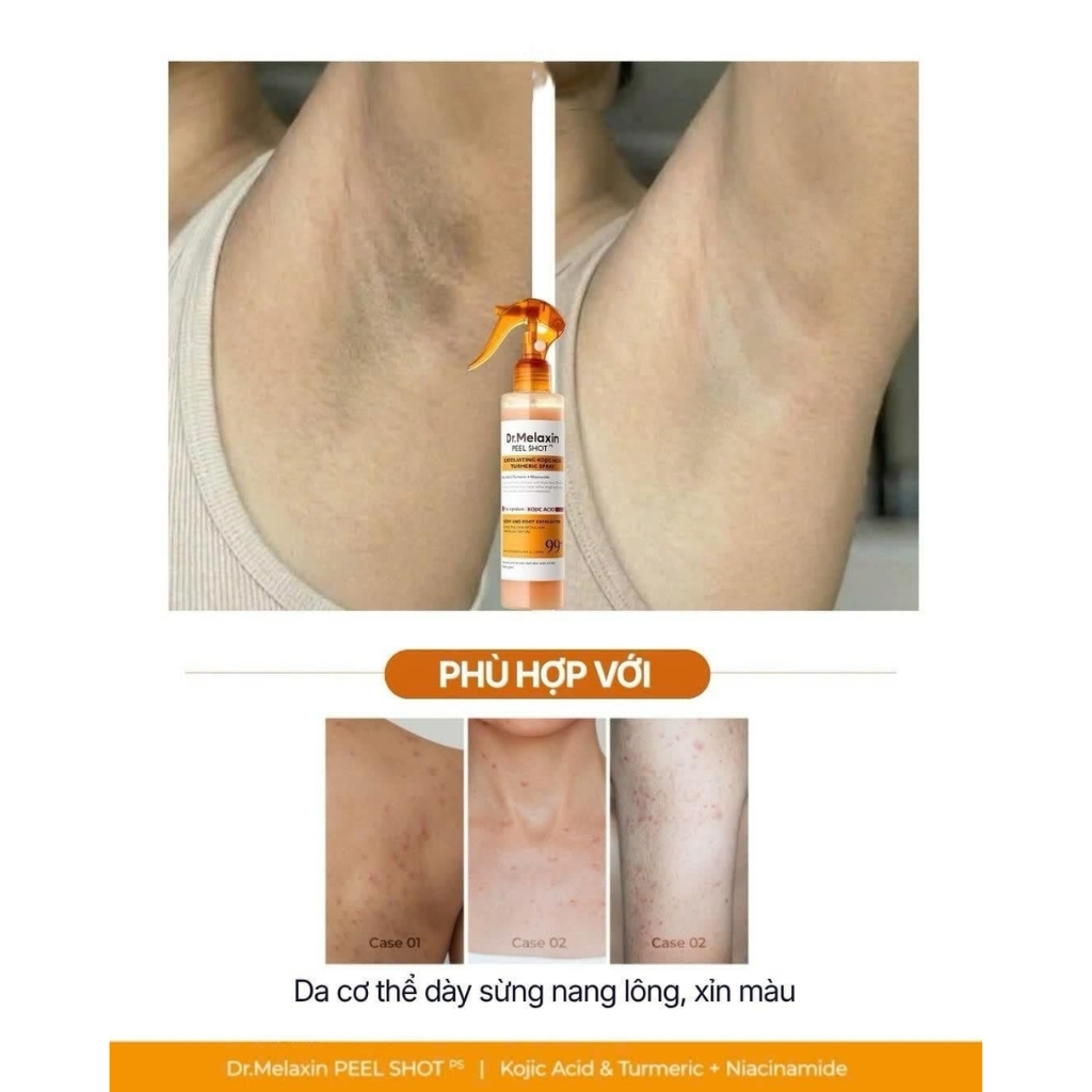 Xịt tẩy tế bào chết Body Dr Melaxin Peel Shot Kojic Acid 200ml | BigBuy360 - bigbuy360.vn