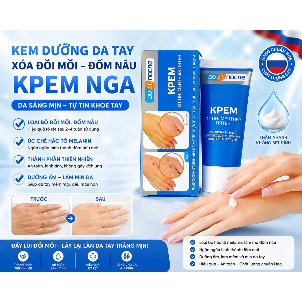[Chính Hãng] Kem Dưỡng Da Tay Xóa Đồi Mồi Đốm Nâu KPEM Nga - 1 Tuýp