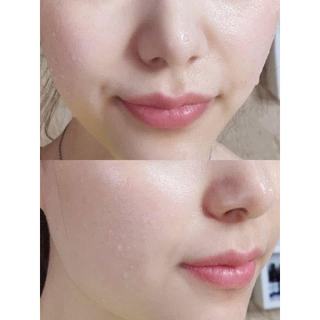 Set sữa rửa mặt Ohui White 160ml + 100ml