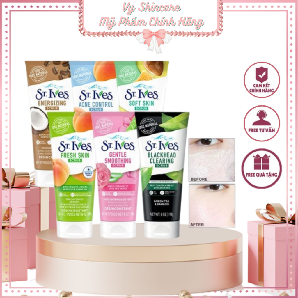 Sữa rửa mặt tẩy tế bào chết St.Ives 170g