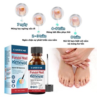 Tinh chất phục hồi móng hư tổn