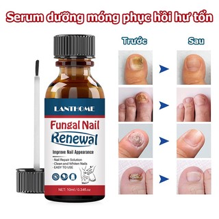 Tinh chất phục hồi móng hư tổn