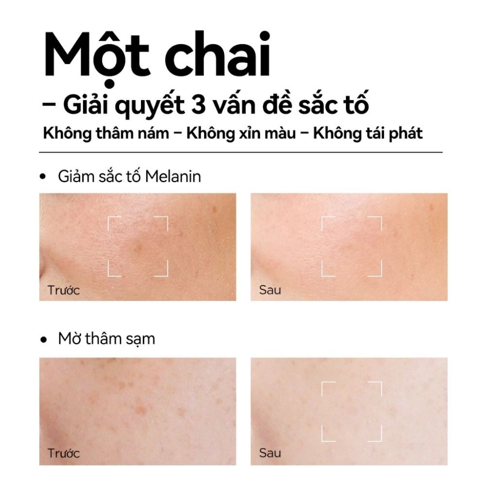 Ảnh 3 của Kem dưỡng ẩm FOCALSKIN MOISTURIZING CALMING CREAM giúp làm dịu da, cấp ẩm, sáng khỏe 35g.