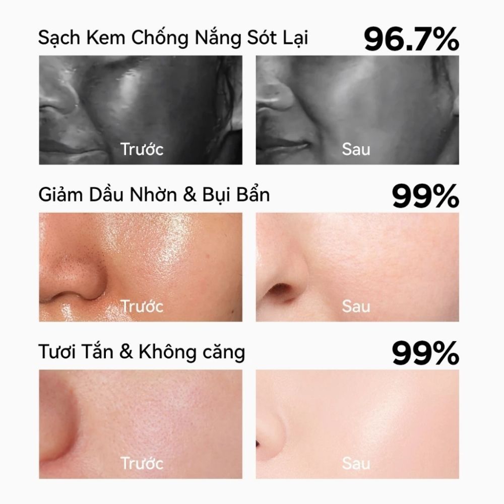 Ảnh 5 của Sữa rửa mặt FOCALSKIN AMINOACID FACIAL CLEANSER giúp loại bỏ dầu thừa, bổ sung độ ẩm cho da 115g.