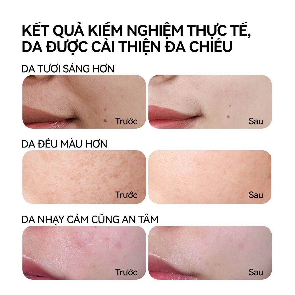 Ảnh 6 của Serum FOCALSKIN BRIGHTENING SERUM giúp cấp độ ẩm, dưỡng trắng da, mờ thâm 30ml.